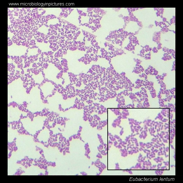eubacterium lentum micrograph