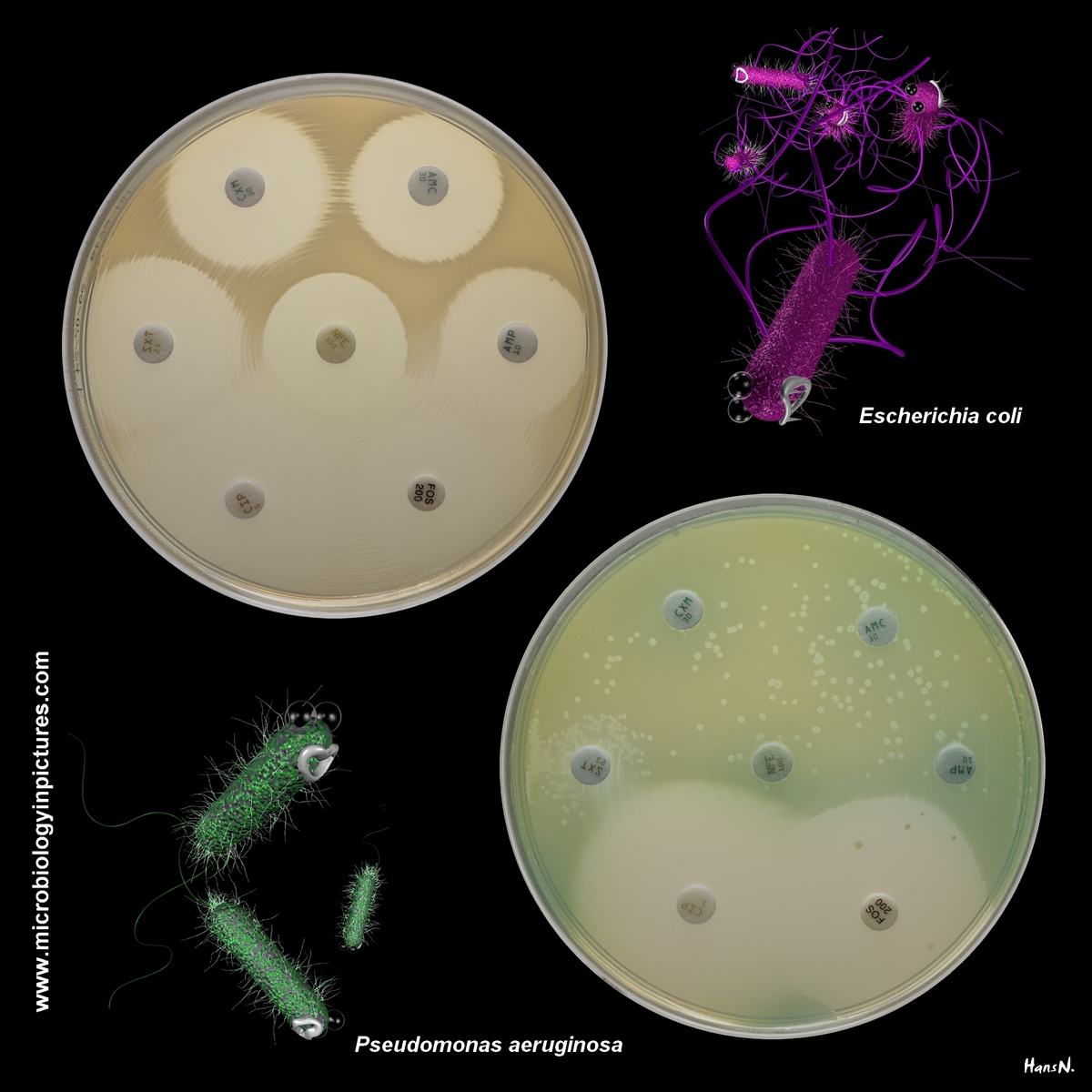 E.coli and P.aeruginosa antibiotic resistance comparison