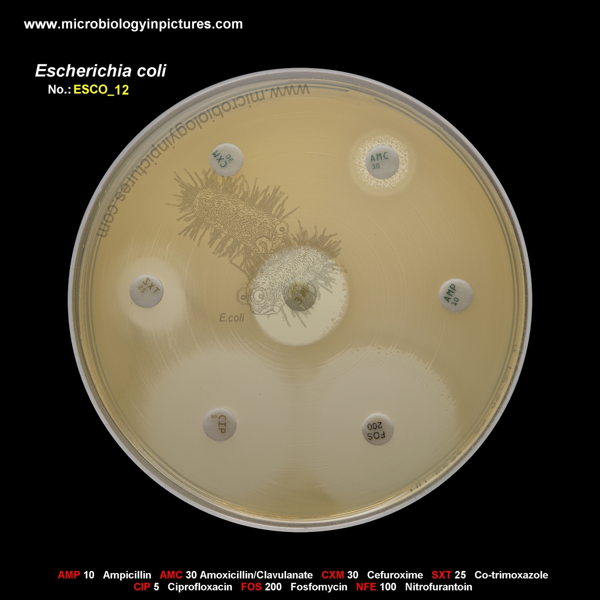 E.coli ESBL