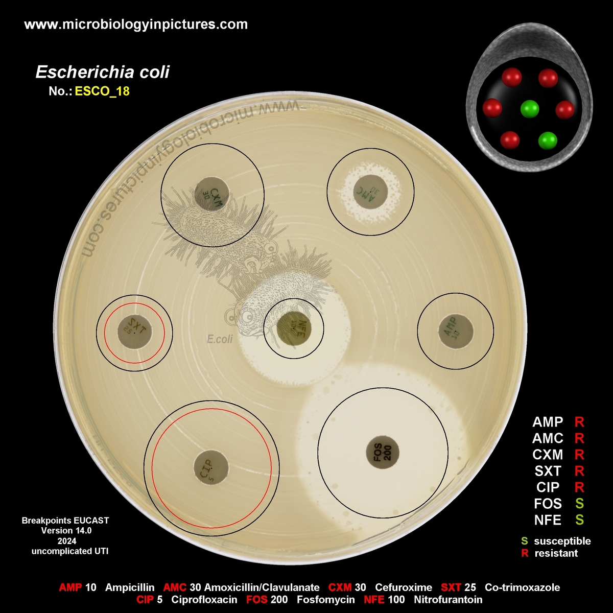 multiresistant strain of E.coli