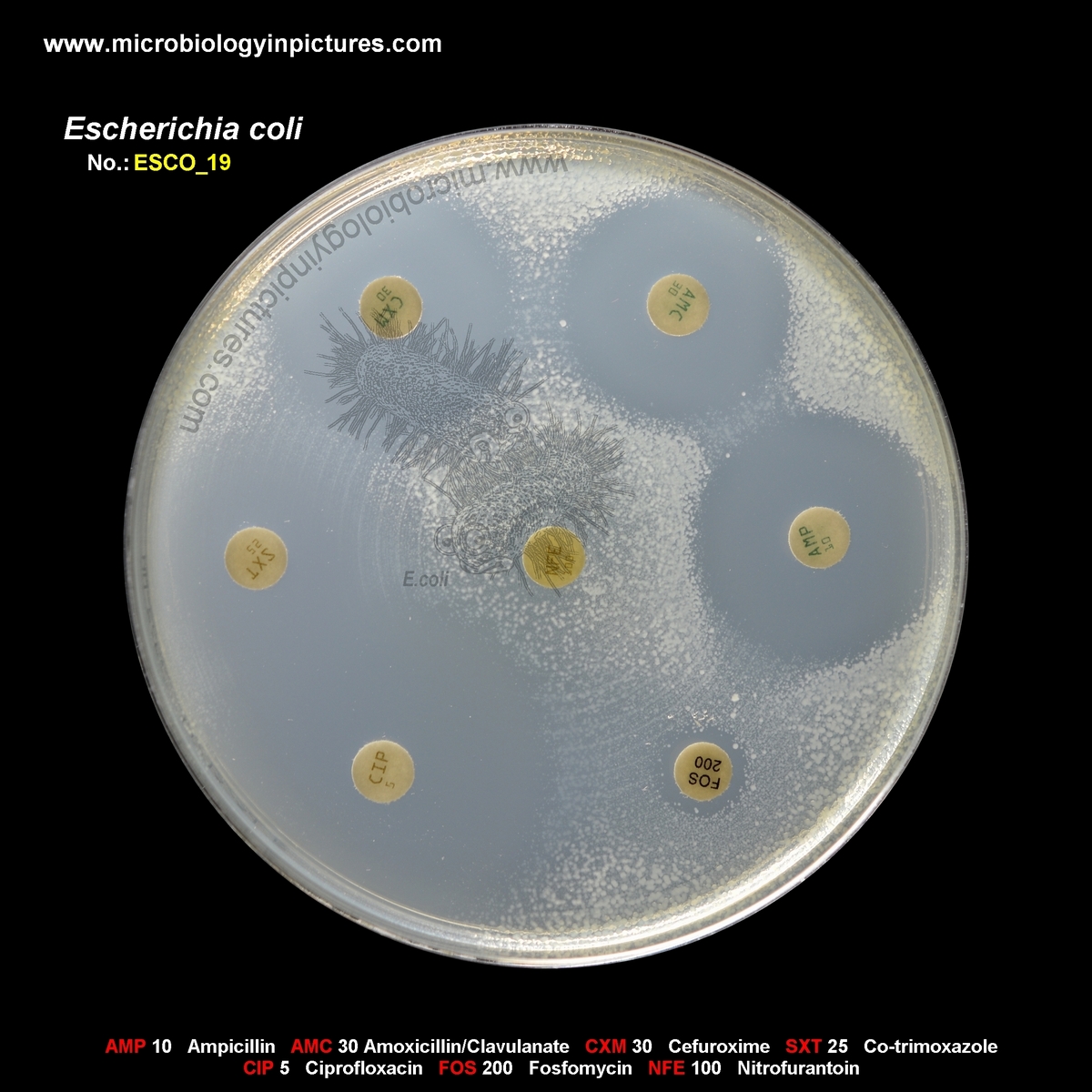 E.coli resistant to nitrofurantoin and fosfomycin