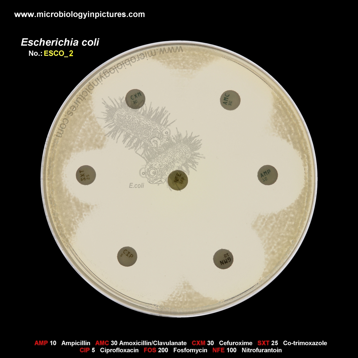 E.coli susceptible to antibiotics