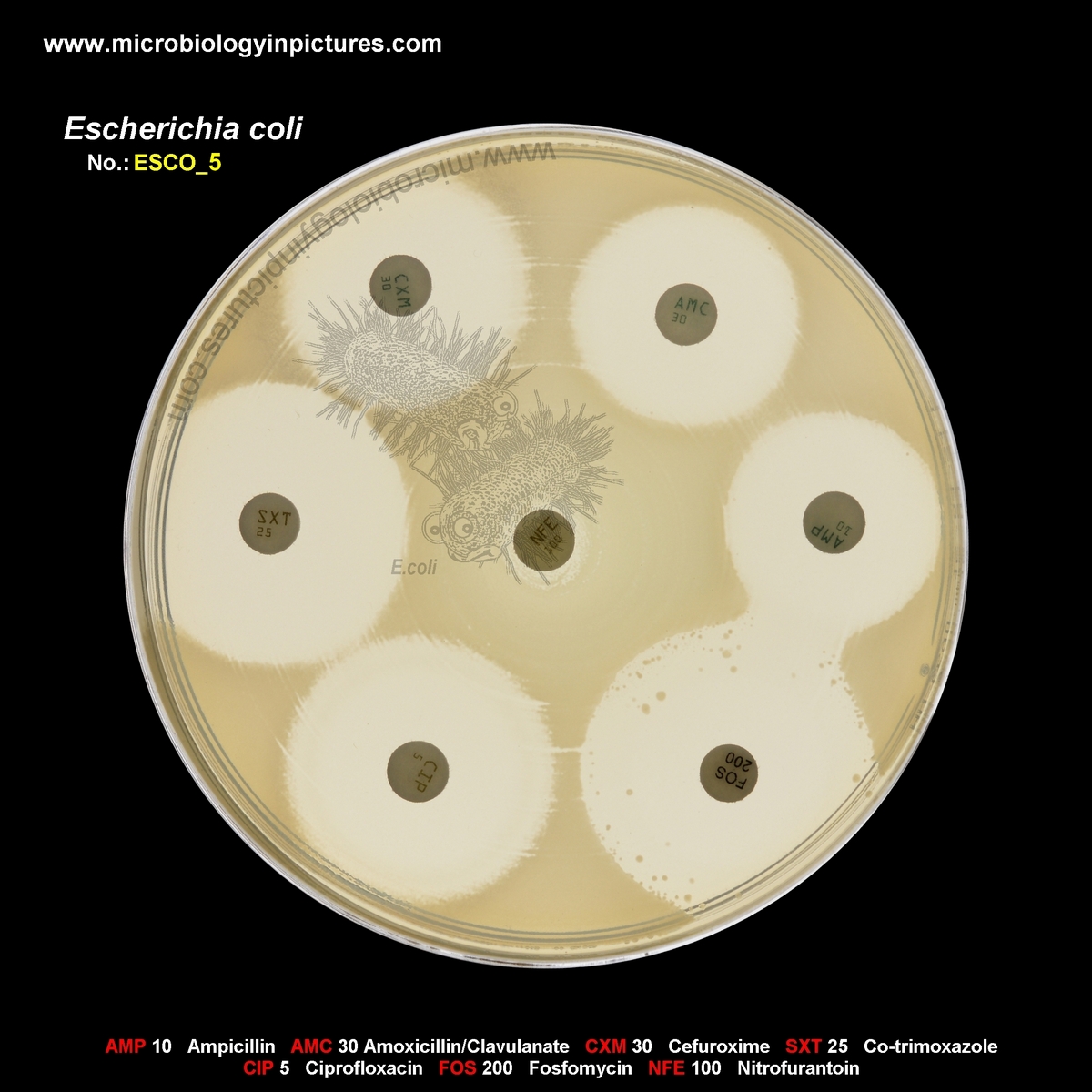 E.coli resistant to nitrofurantoin