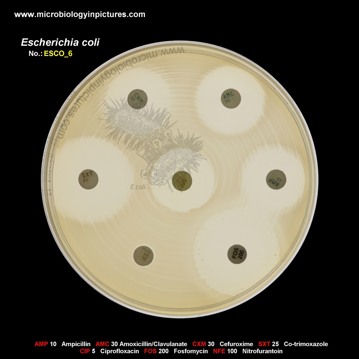 E.coli resistant to ciprofloxacin