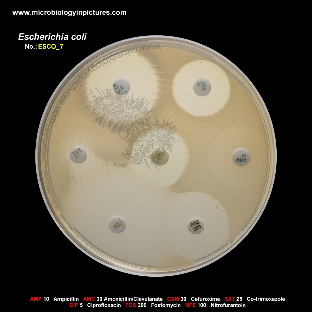 E.coli resistant to co-trimoxazole (trimethoprim/sulfamethoxazole)