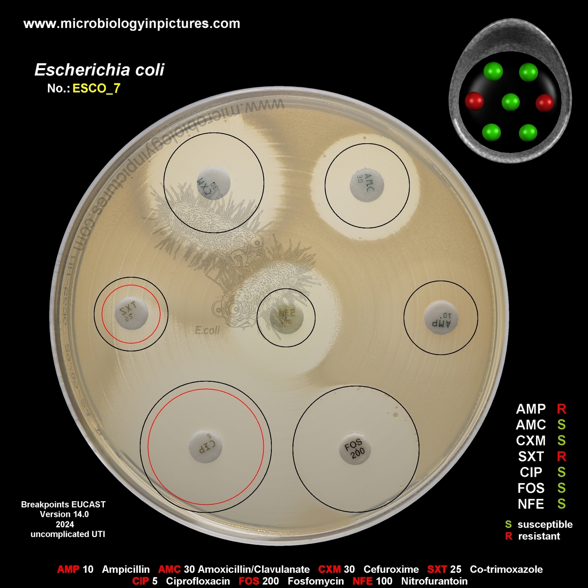 E.coli resistant to co-trimoxazole (trimethoprim/sulfamethoxazole)