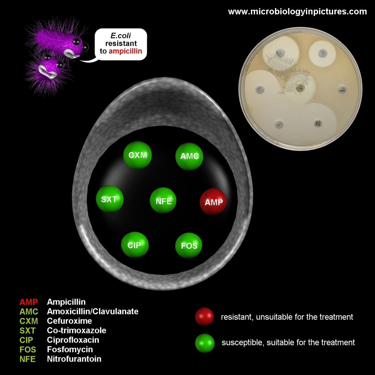 Inodulated plate with the antibiotic disks