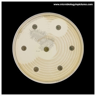 inoculated Petri dish with antibiotic disks overnight cultivation