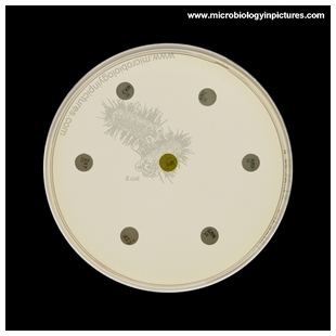 inoculated Petri dish with antibiotic disks