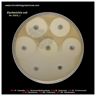 E.coli susceptible strain