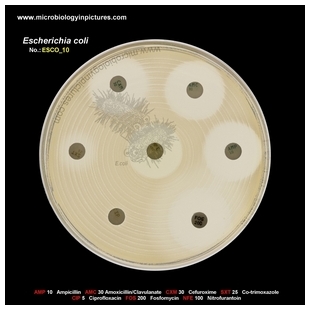 E.coli resistant to Trimethoprim-Sulfamethoxazole (Co-trimoxazole), TMP-SMX