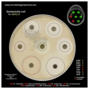 E.coli resistant to Trimethoprim-Sulfamethoxazole (Co-trimoxazole), TMP-SMX