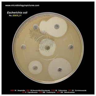 E.coli ESBL positive