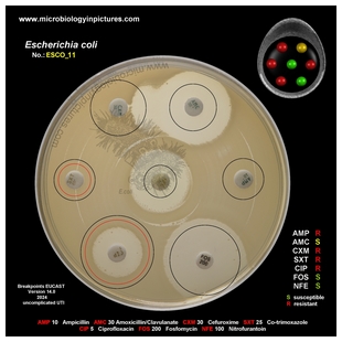 E.coli ESBL positive