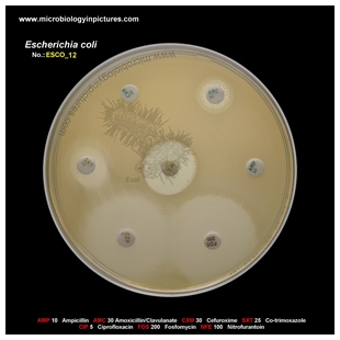 E.coli ESBL+