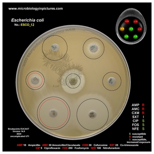 E.coli ESBL+