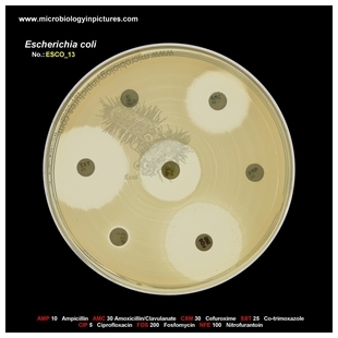 E.coli ESBL positive, Augmentin susceptible