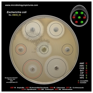 E.coli 