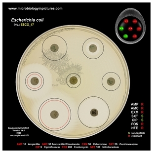 E.coli 