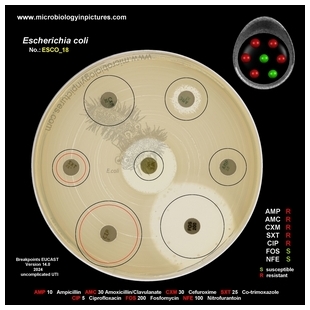 E.coli ESBL