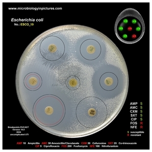 E.coli ESBL