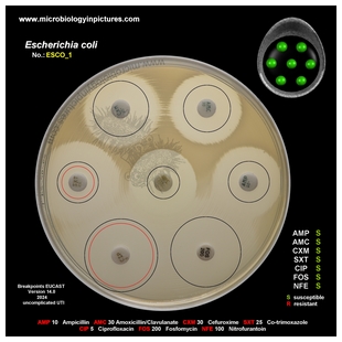 E.coli susceptible strain