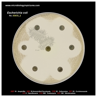 E.coli susceptible strain