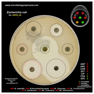 E.coli ESBL