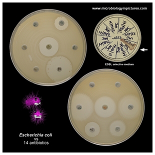 ESBL E.coli