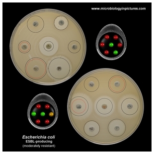 E.coli ESBL