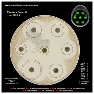 E.coli susceptible strain