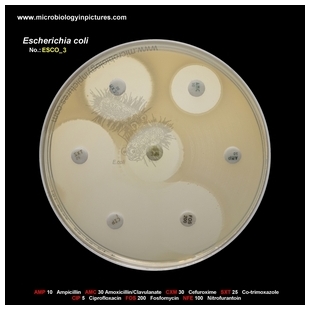 E.coli resistant to ampicillin