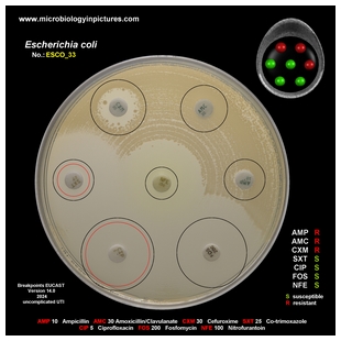 AmpC positive E.coli