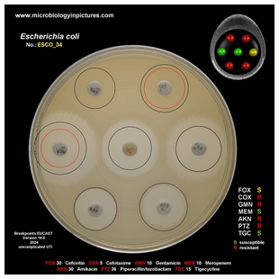 ESBL positive E.coli