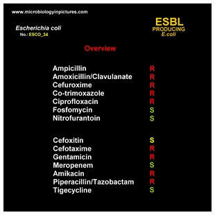 ESBL producing E.coli