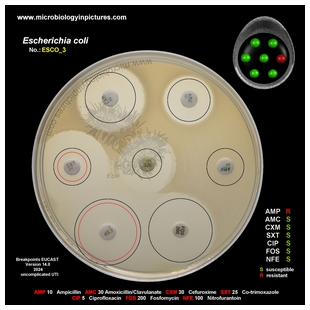 E.coli resistant to ampicillin