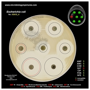 E.coli resistant to co-trimoxazole