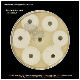 E.coli resistant to nitrofurantoin