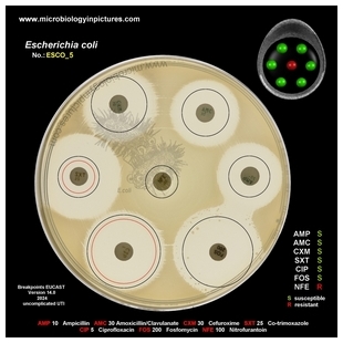 E.coli resistant to nitrofurantoin