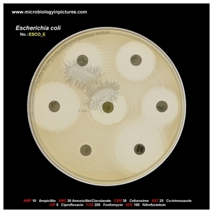 E.coli resistant to fluorochinolones