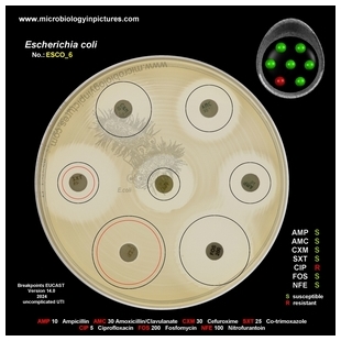 E.coli resistant to fluorochinolones