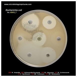 E.coli resistant to ampicillin and co-trimoxazole