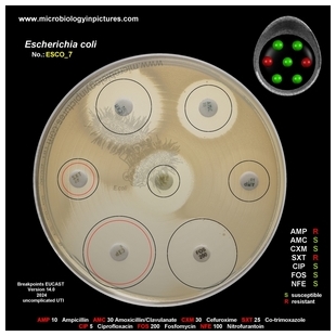 E.coli resistant to ampicillin and co-trimoxazole