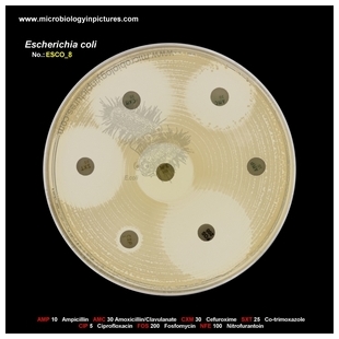 E.coli resistant to ampicillin and ciprofloxacin