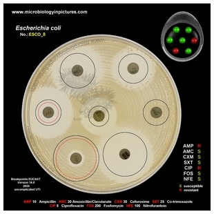 E.coli resistant to ampicillin and ciprofloxacin