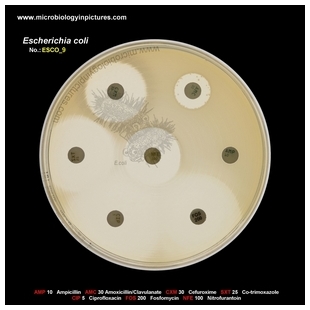 E.coli resistant to ampicillin and amoxicillin/clavulanate