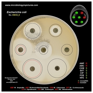 E.coli resistant to ampicillin and amoxicillin/clavulanate