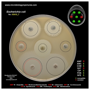 non-ESBL E.coli