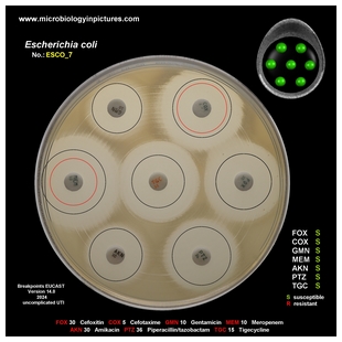 non-ESBL E.coli