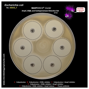 non-ESBL E.coli